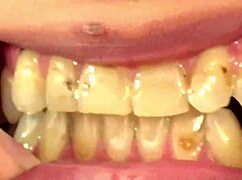 i'm watching fifi foxx eat gummy bears up close with mouth vore