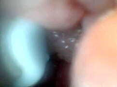 Endoscope Reveals Sensitive Penis Areas In Educational Video