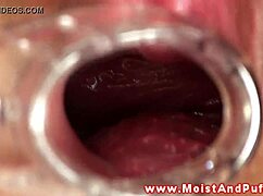 Puffy Peach Teen Plays With Speculum In Close Up